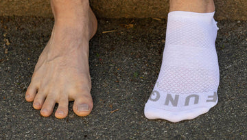 HALLUX VALGUS – VILKA STRUMPOR KAN HJÄLPA?